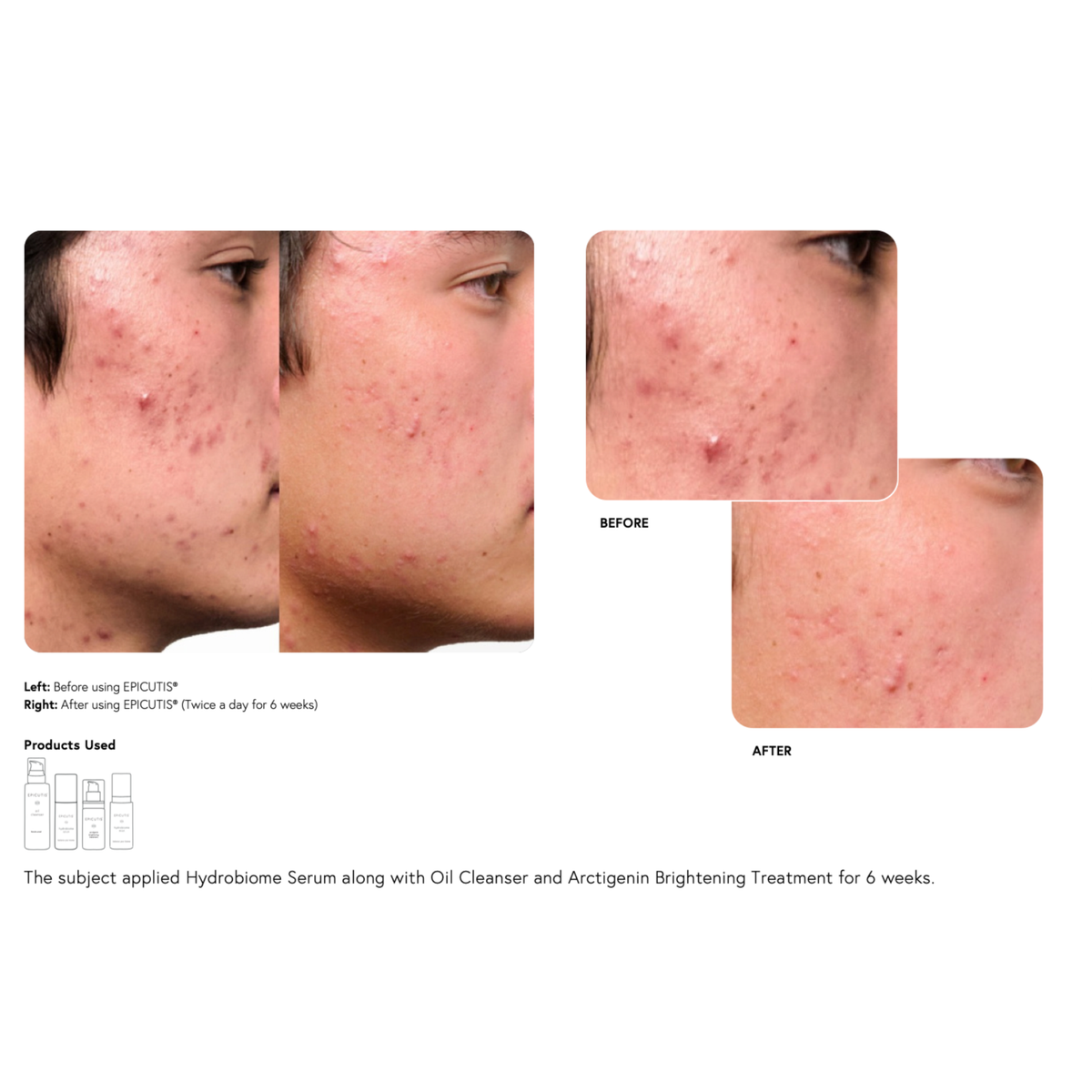 Epicutis Hydrobiome Serum