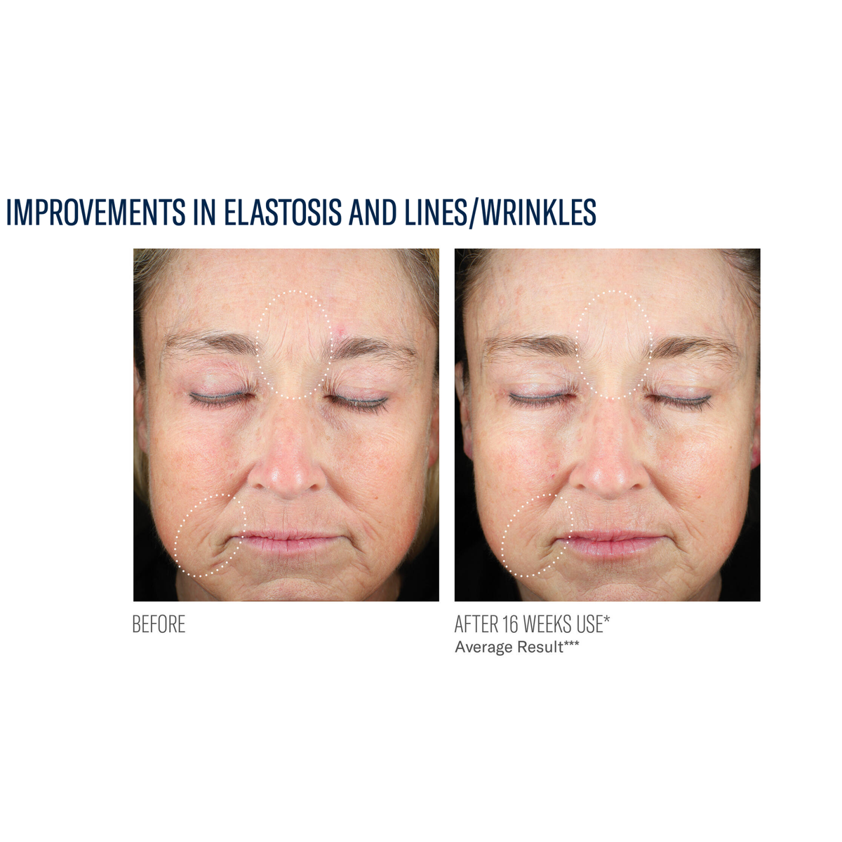 SkinBetter Science Mystro Revive Renewing Serum, fourth view