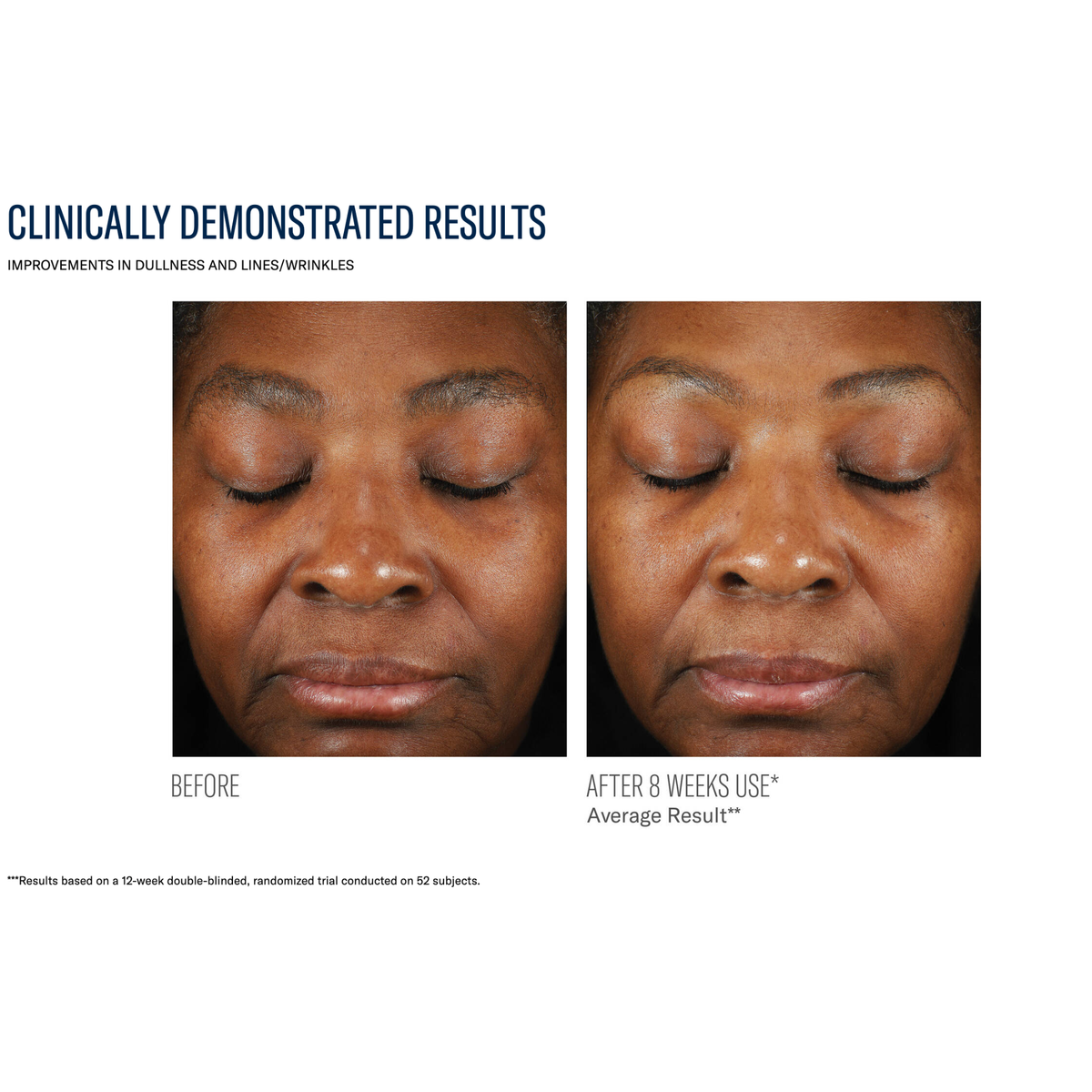 SkinBetter Science Mystro Revive Renewing Serum, fifth view