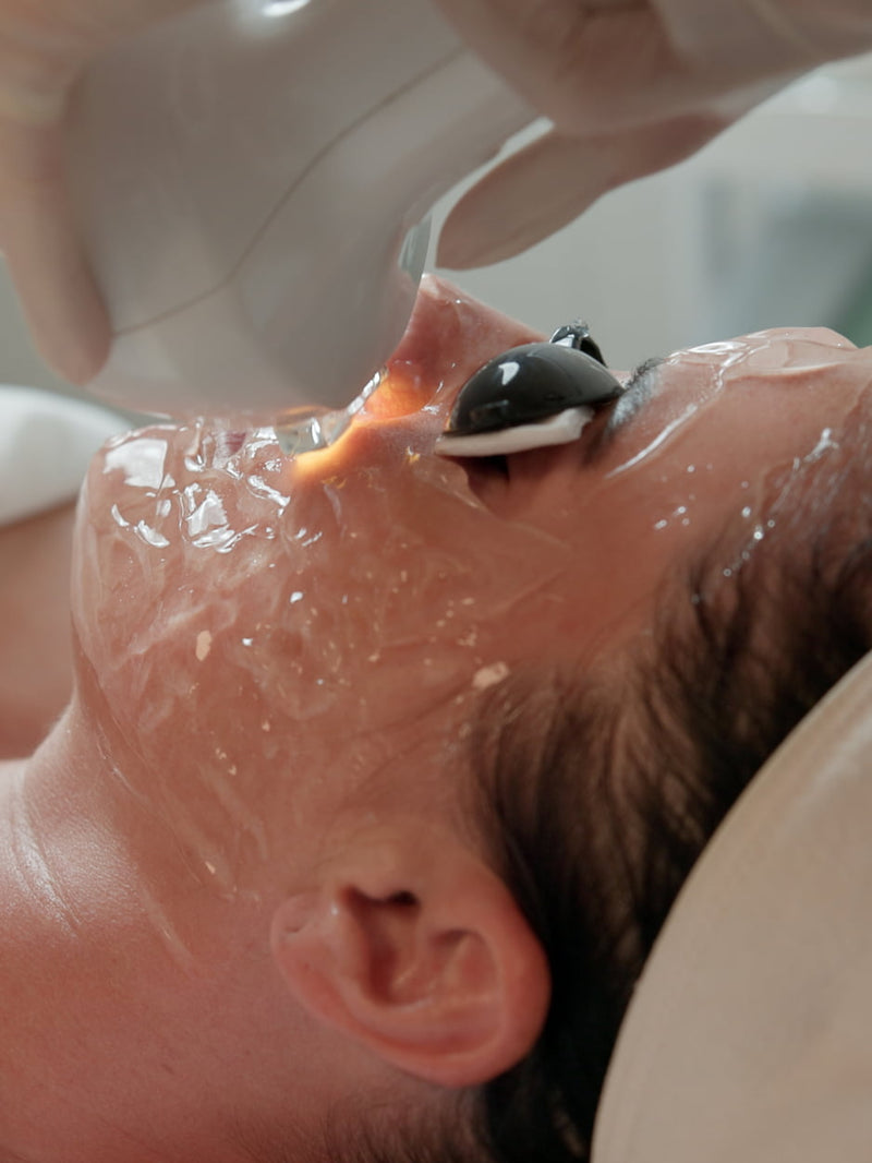Targeted IPL