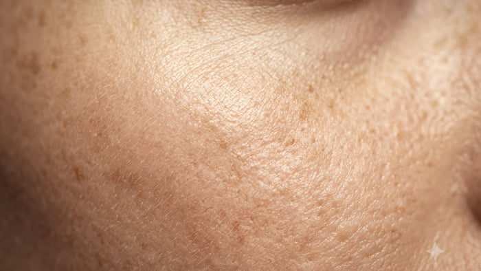 Pigmentation