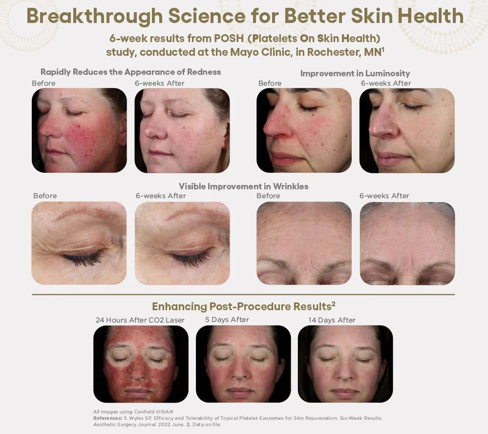 (plated) Skin Science INTENSE Serum exosome serum, fourth view