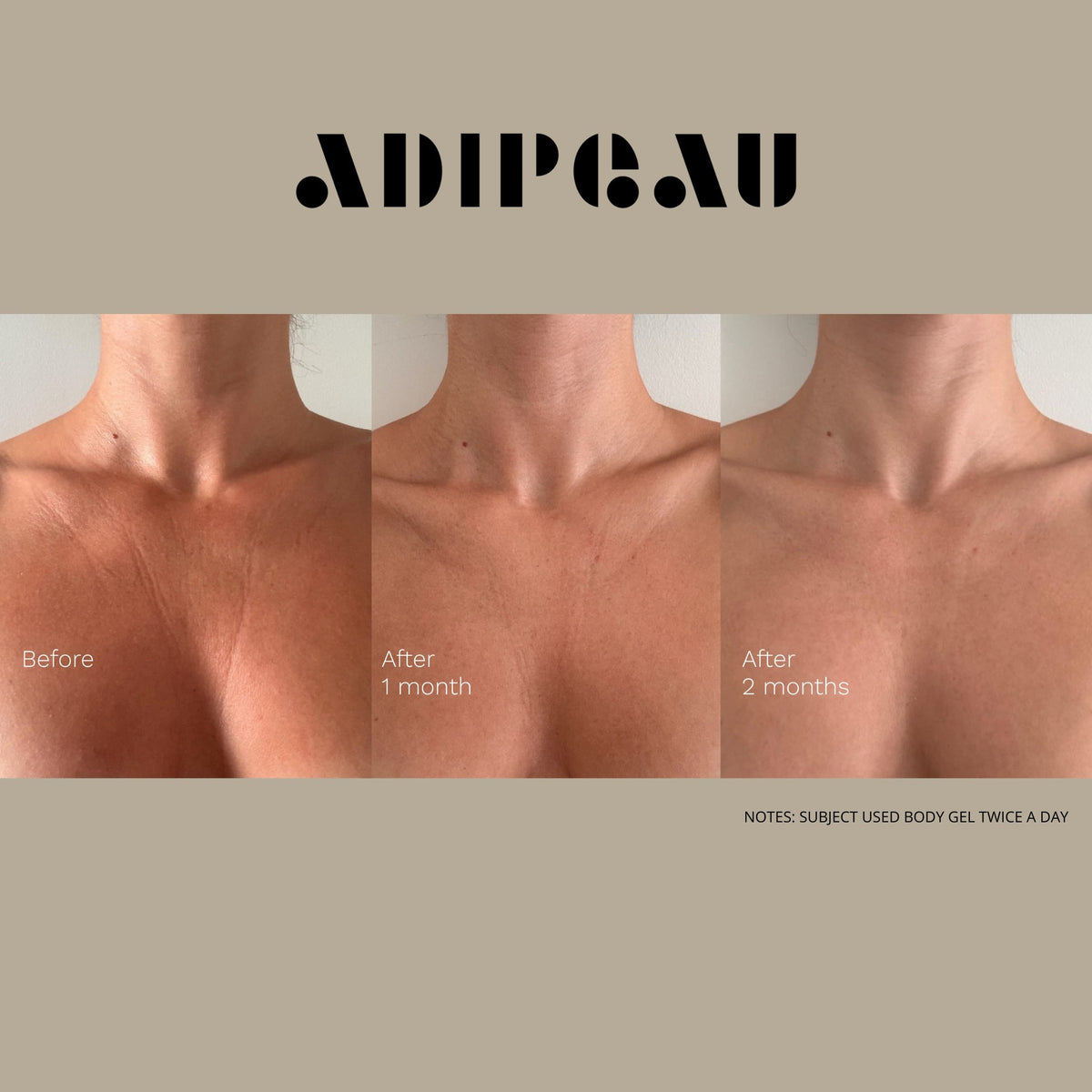 ADIPEAU Strength Gel lifestyle image