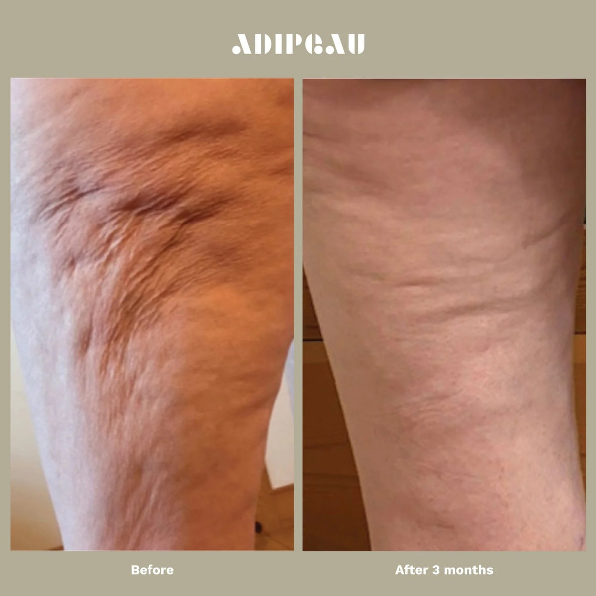 ADIPEAU Strength Gel lifestyle image