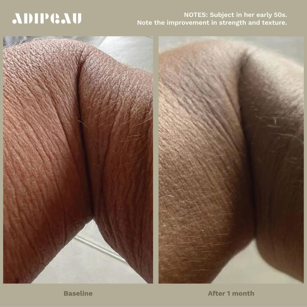 ADIPEAU Strength Gel lifestyle image