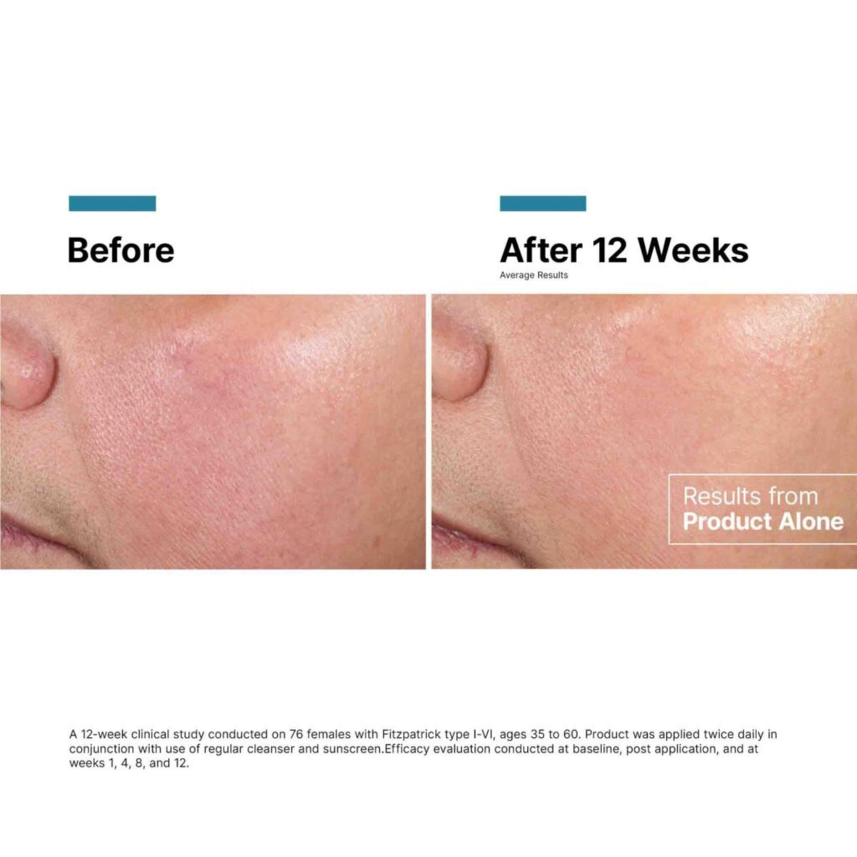 SkinCeuticals Advanced RGN-6 lifestyle image