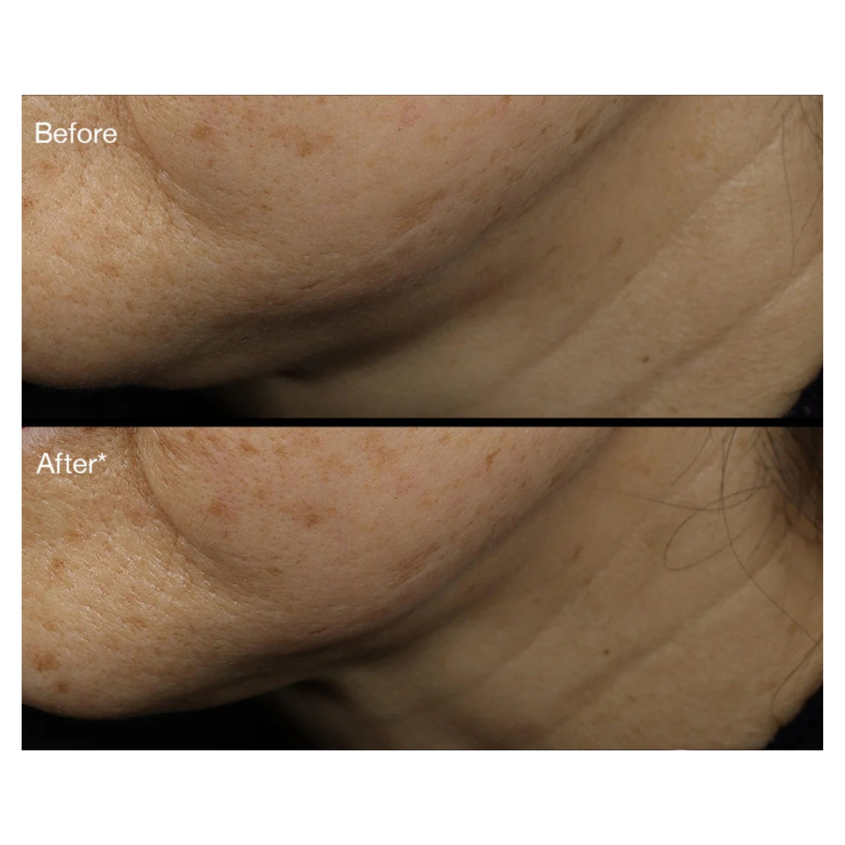 SkinCeuticals A.G.E. Interrupter Ultra Serum lifestyle image