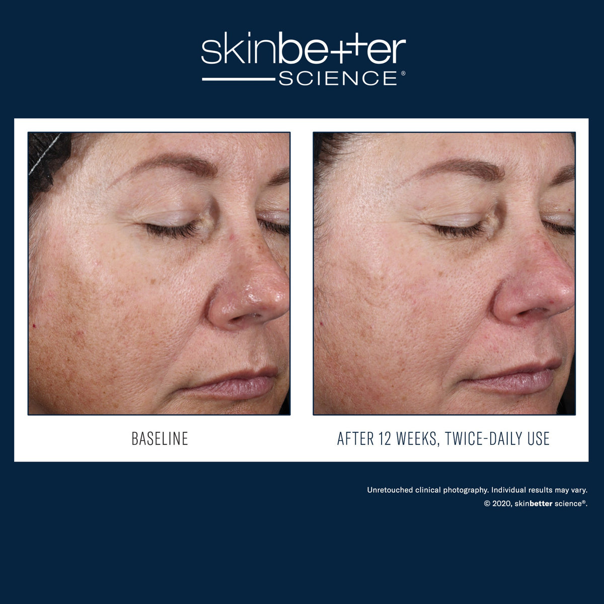 SkinBetter Science Alto Defense and Repair Serum lifestyle image