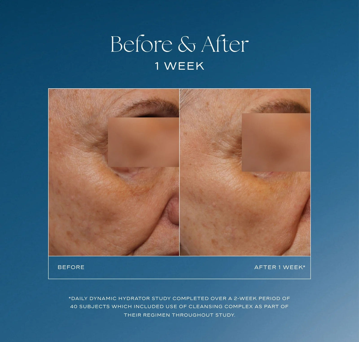 iS Clinical Daily Dynamic Hydrator lifestyle image