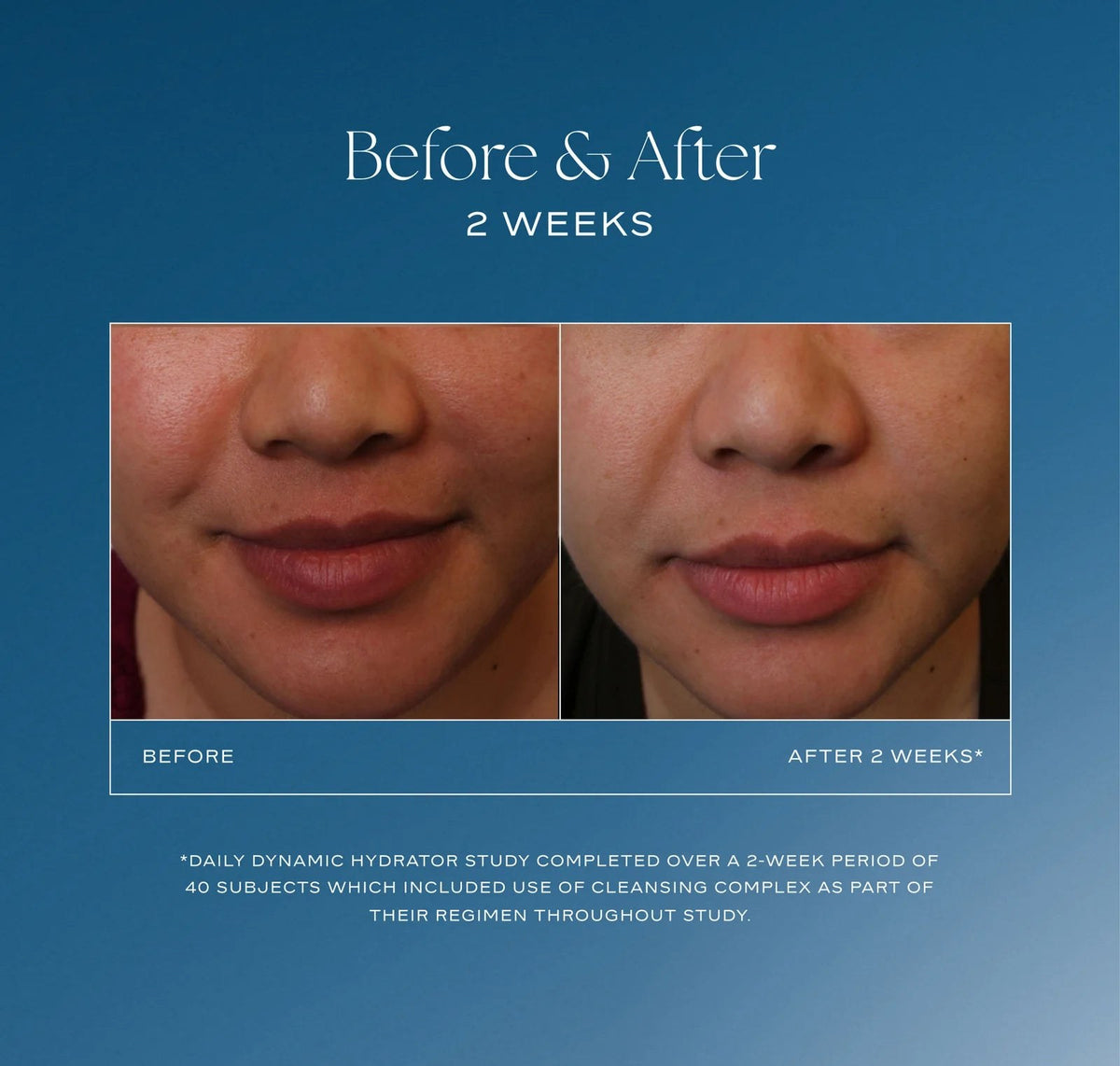 iS Clinical Daily Dynamic Hydrator lifestyle image