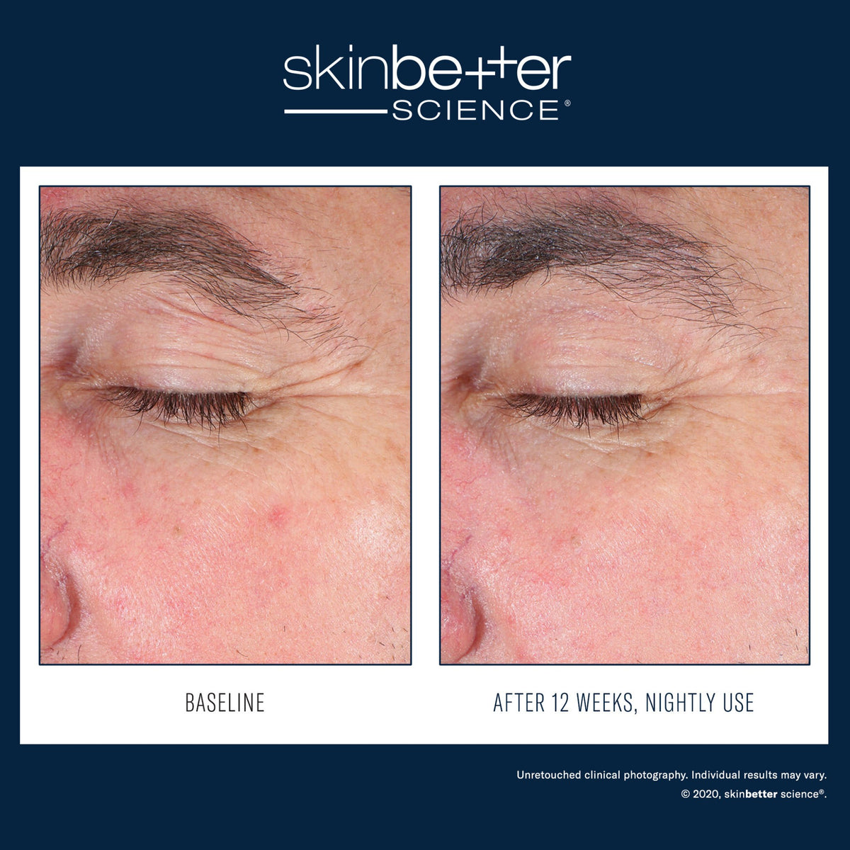 SkinBetter Science EyeMax AlphaRet Overnight Cream lifestyle image