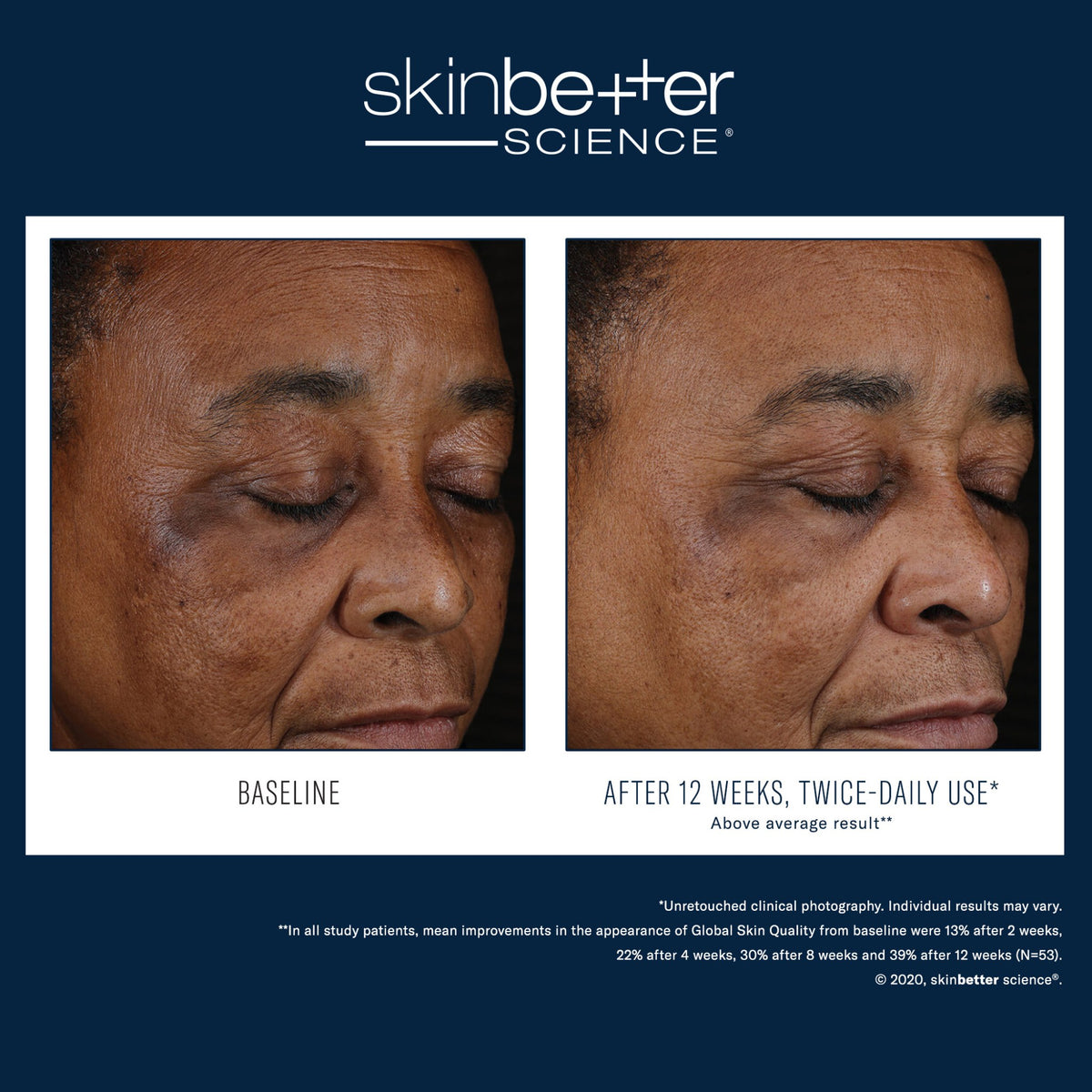 SkinBetter Science Mystro Active Balance Serum lifestyle image