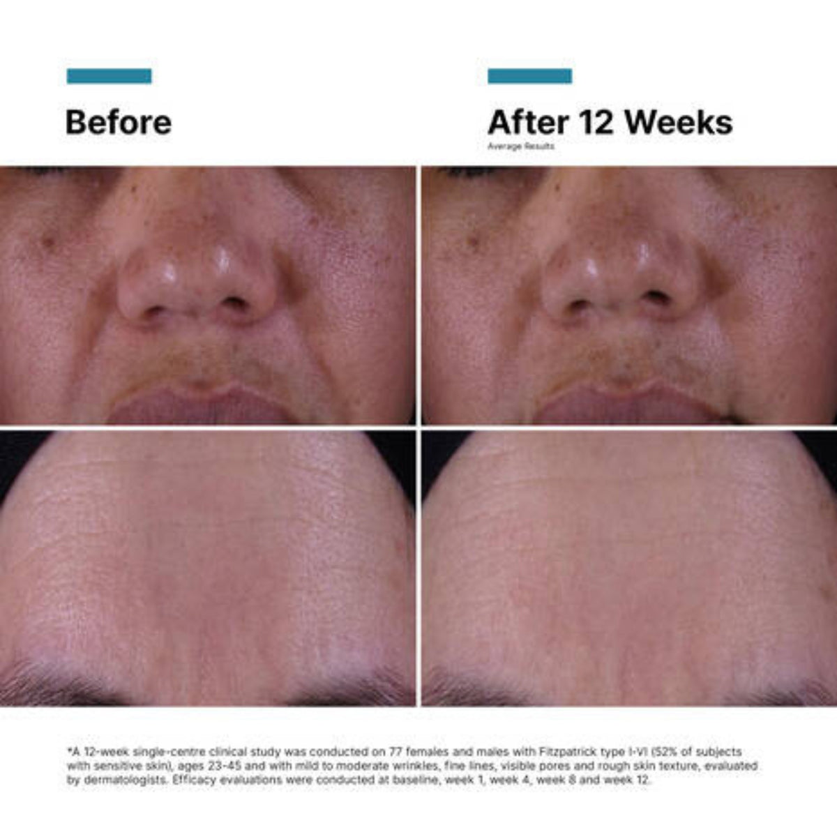 SkinCeuticals P-TIOX Cream lifestyle image