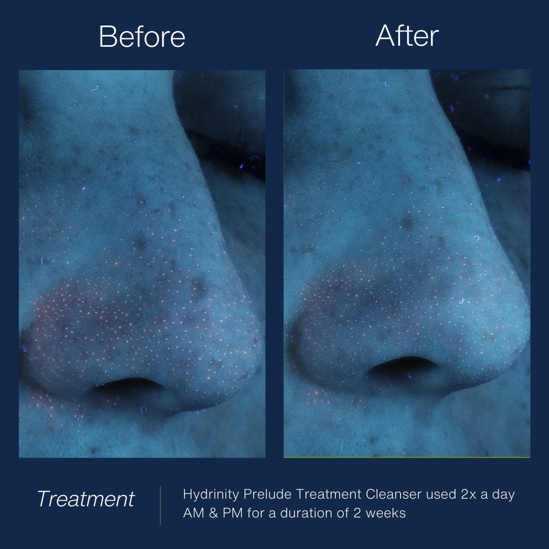 HYDRINITY Prelude Facial Treatment Cleanser lifestyle image