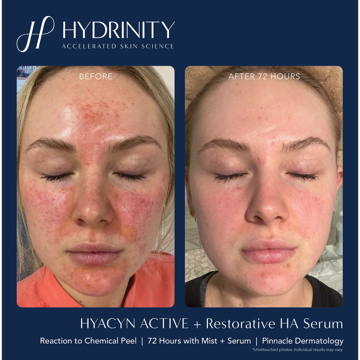 HYDRINITY Restorative Kit lifestyle image