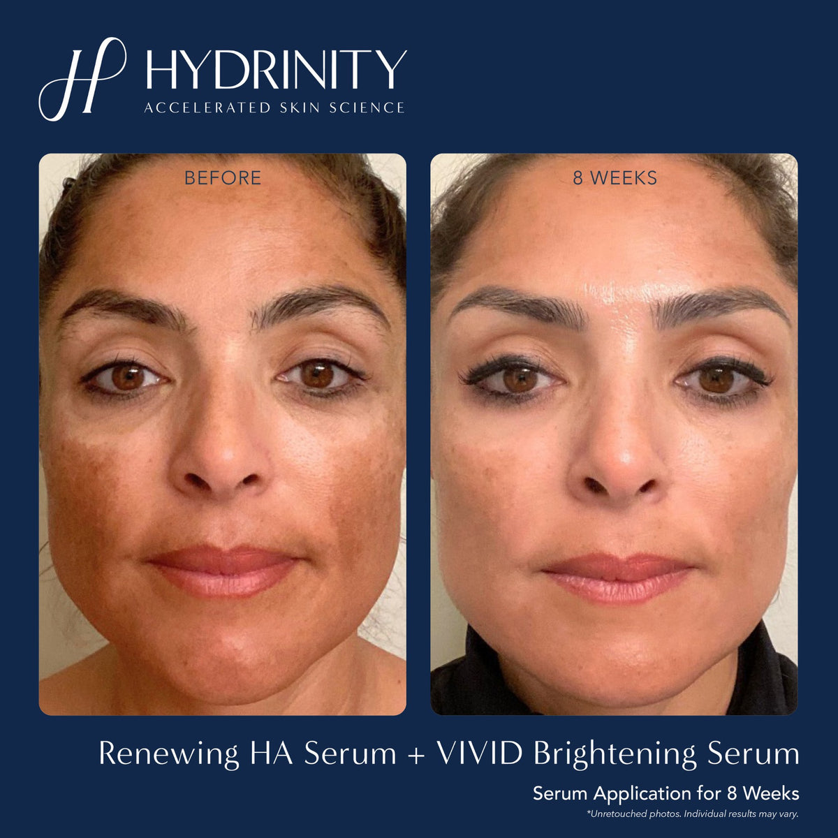 HYDRINITY Vivid Brightening Serum lifestyle image