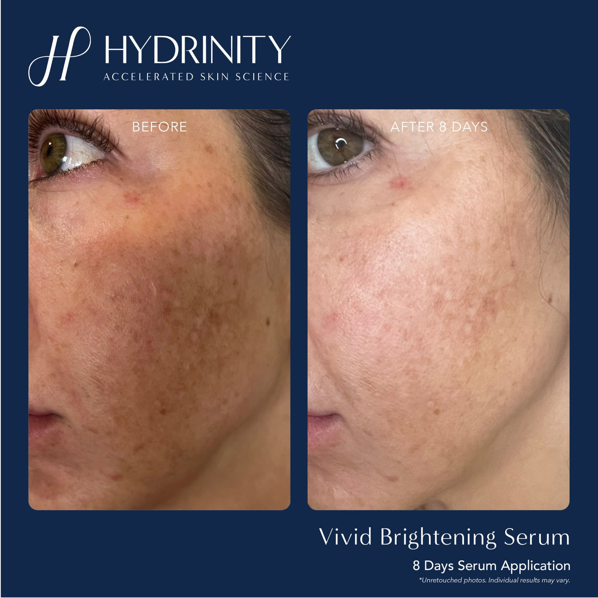 HYDRINITY Vivid Brightening Serum lifestyle image