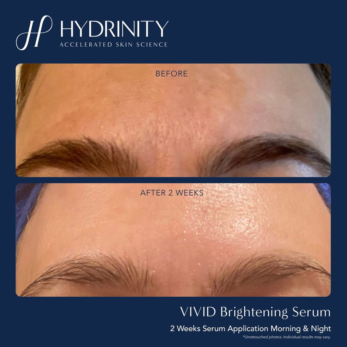 HYDRINITY Vivid Brightening Serum lifestyle image