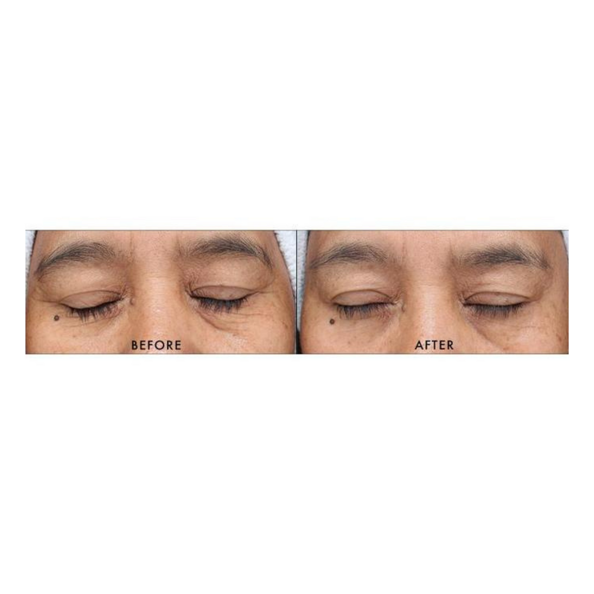 iS Clinical Youth Serum firming serum, fourth view