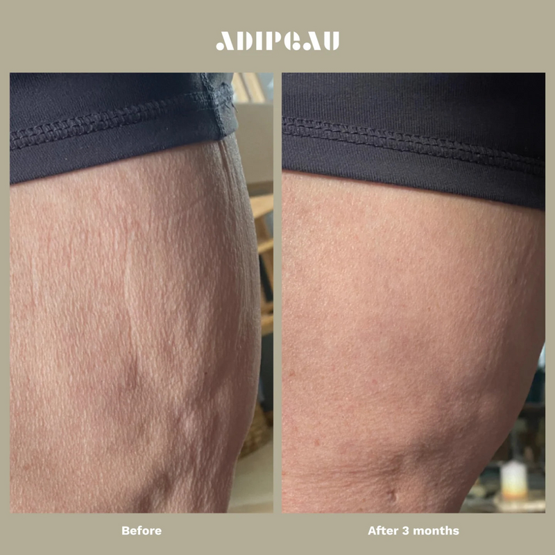 Adipeau: Strong Body Gel