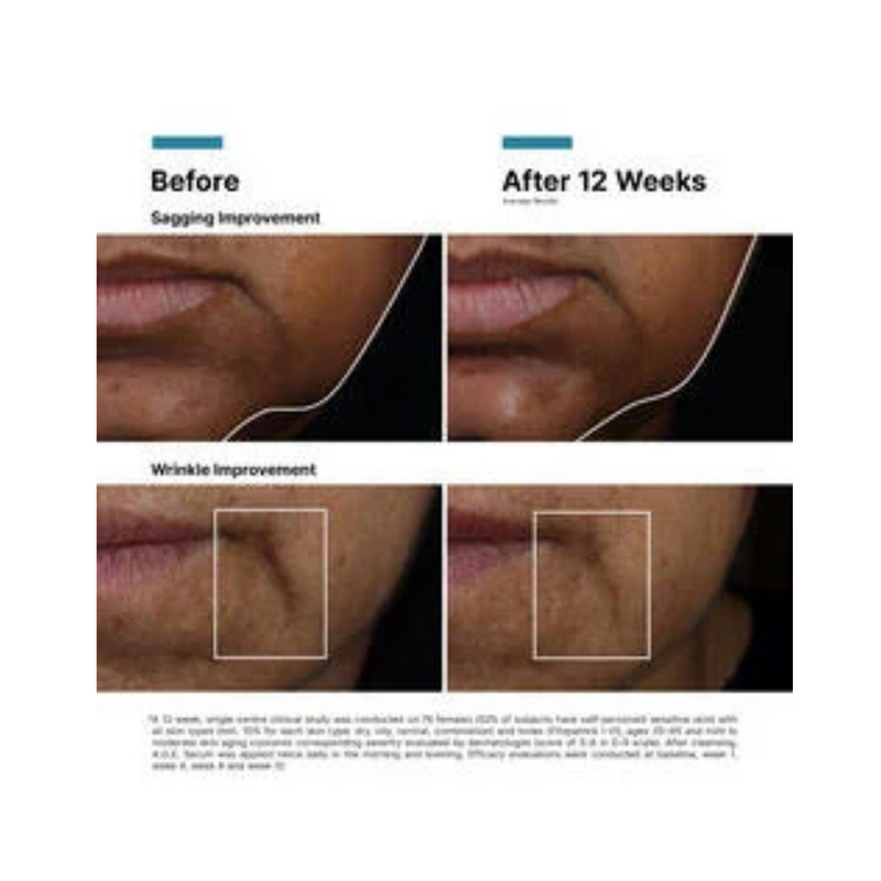A.G.E Interrupter Ultra Serum