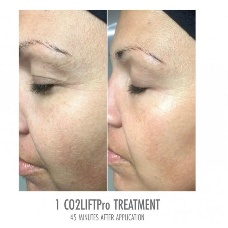 CO2Lift® PRO Mask