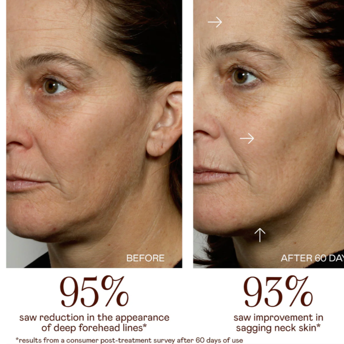 NuFACE MINI+ Hydrate and Sculpt Kit, second view