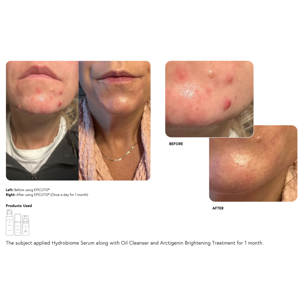 Epicutis Hydrobiome Serum