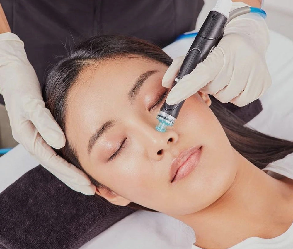 Model undergoing Morpheus8 treatment for facial rejuvenation at Studios Vis a Vis Toronto