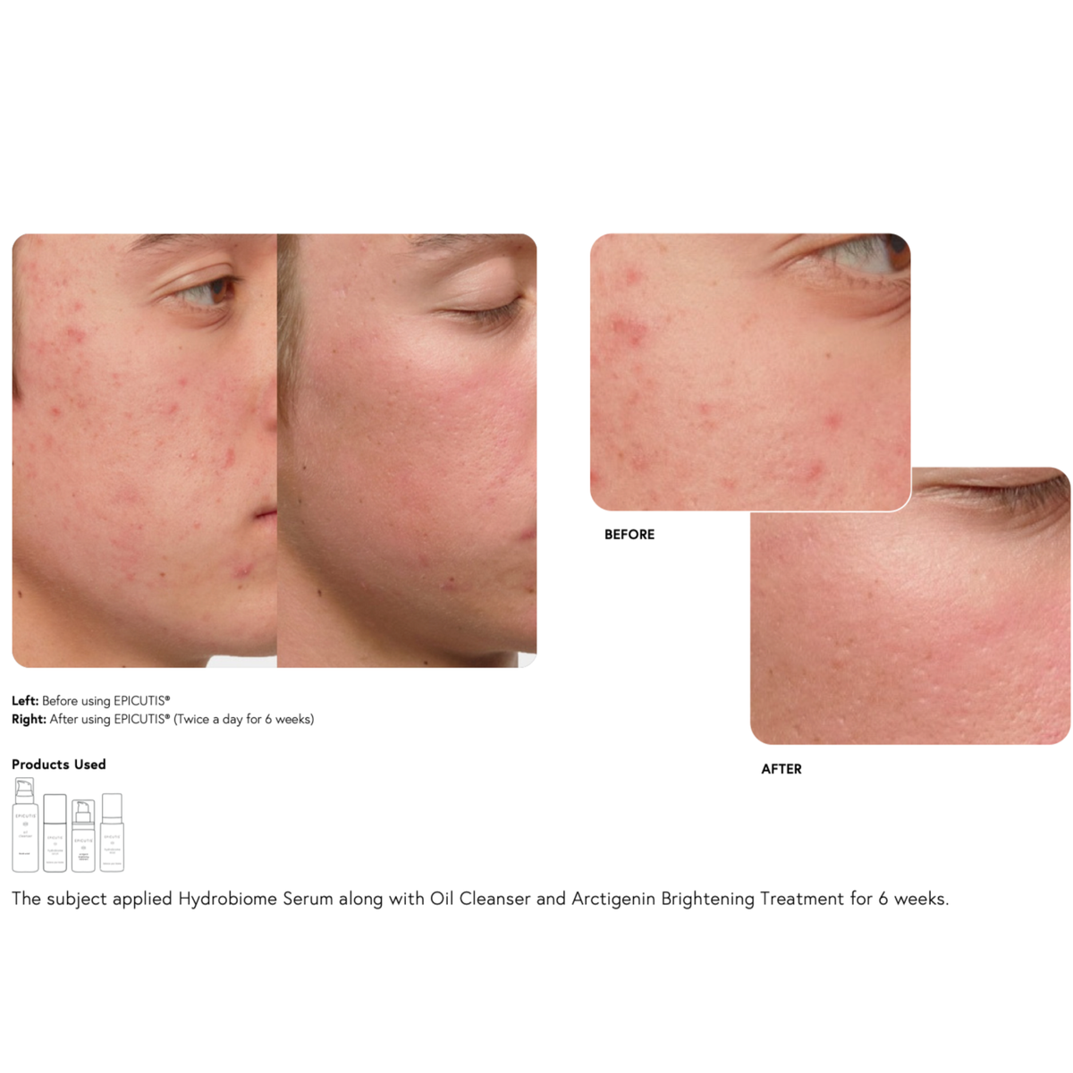 Epicutis Hydrobiome Serum