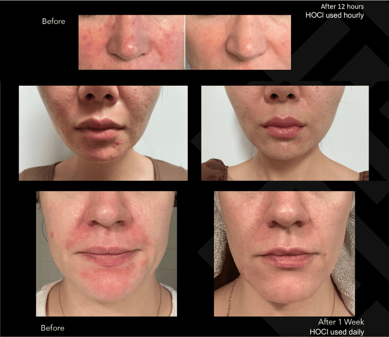 Hale Derma