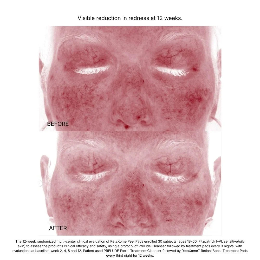 HYDRINITY RetaXome Retinal Boost Pads, fourth view