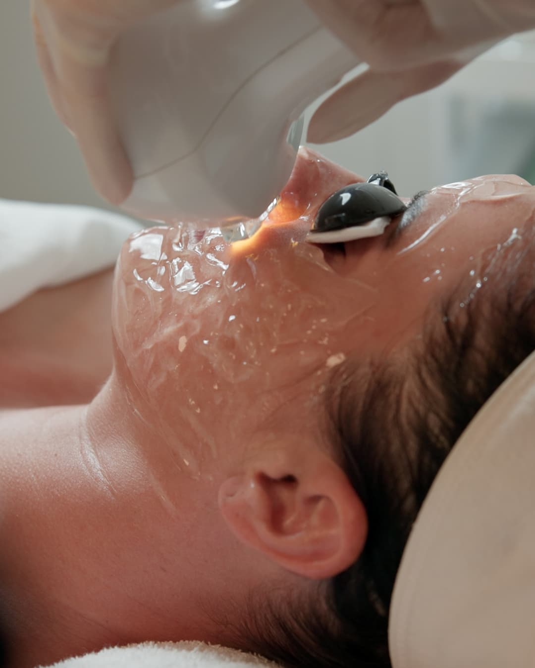 Pigmentation & Redness Correction Package