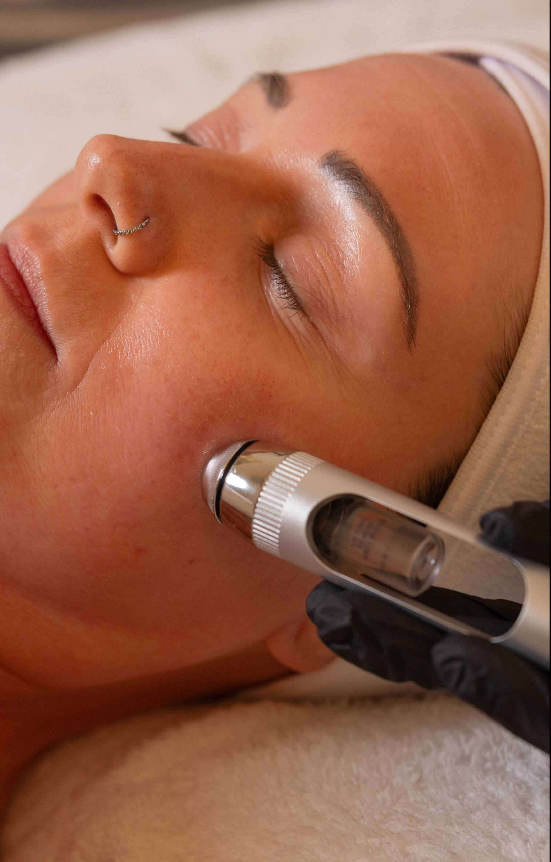 Client receiving LIFTED facial at Vis A Vis with serum infusion using Dermotechnology device