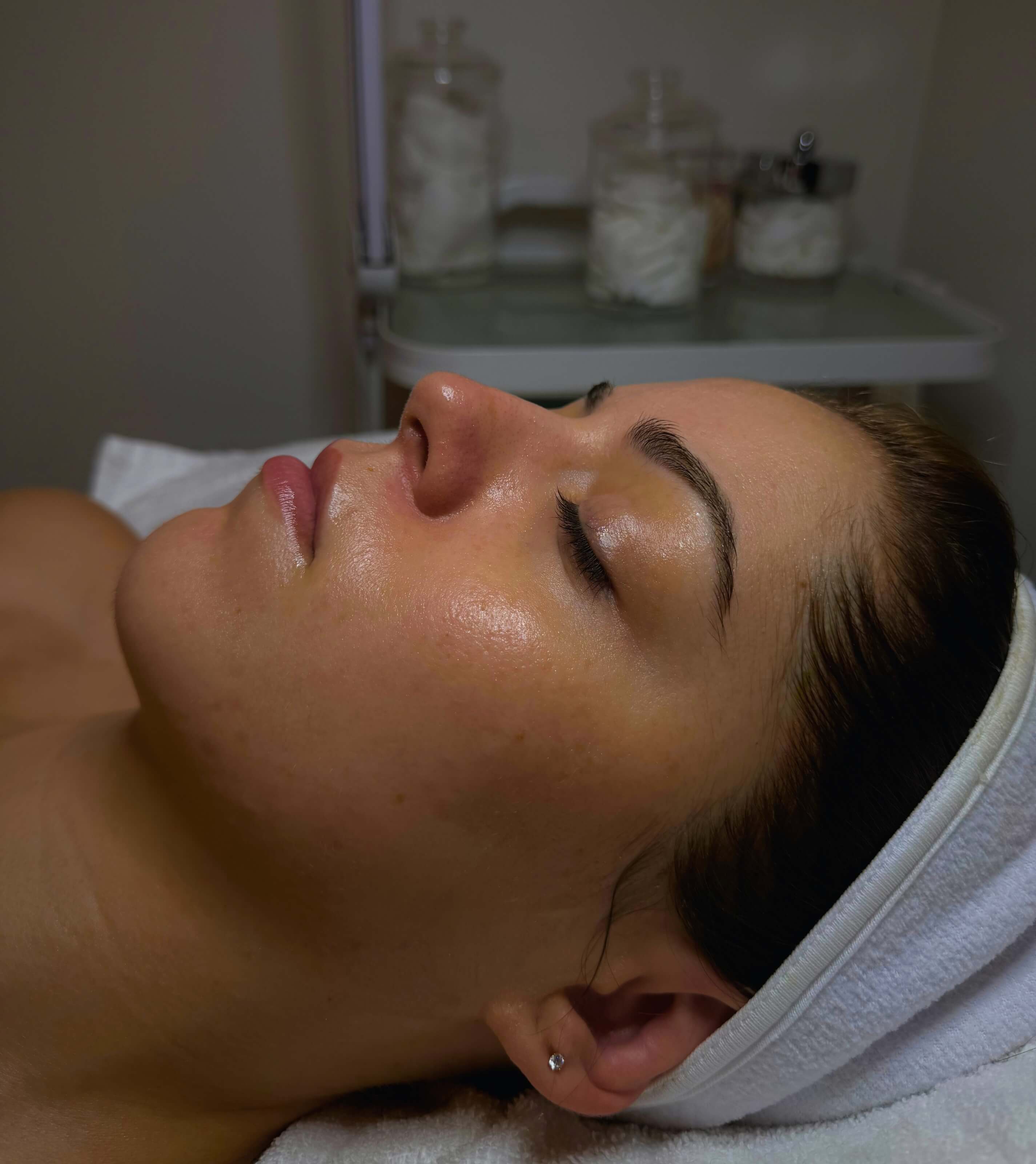 Client with glowing skin after just one treatment