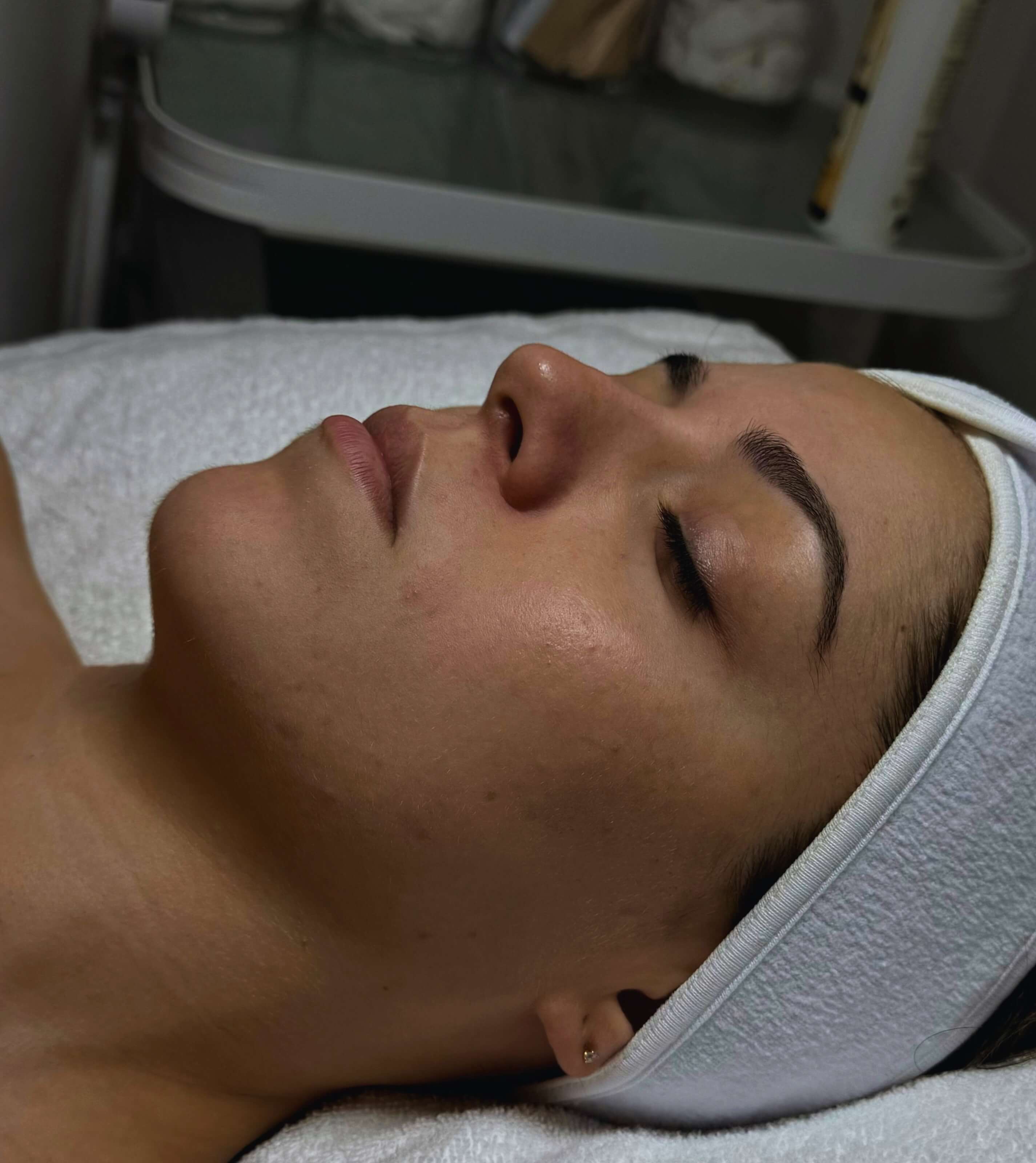 Client with dull complexion