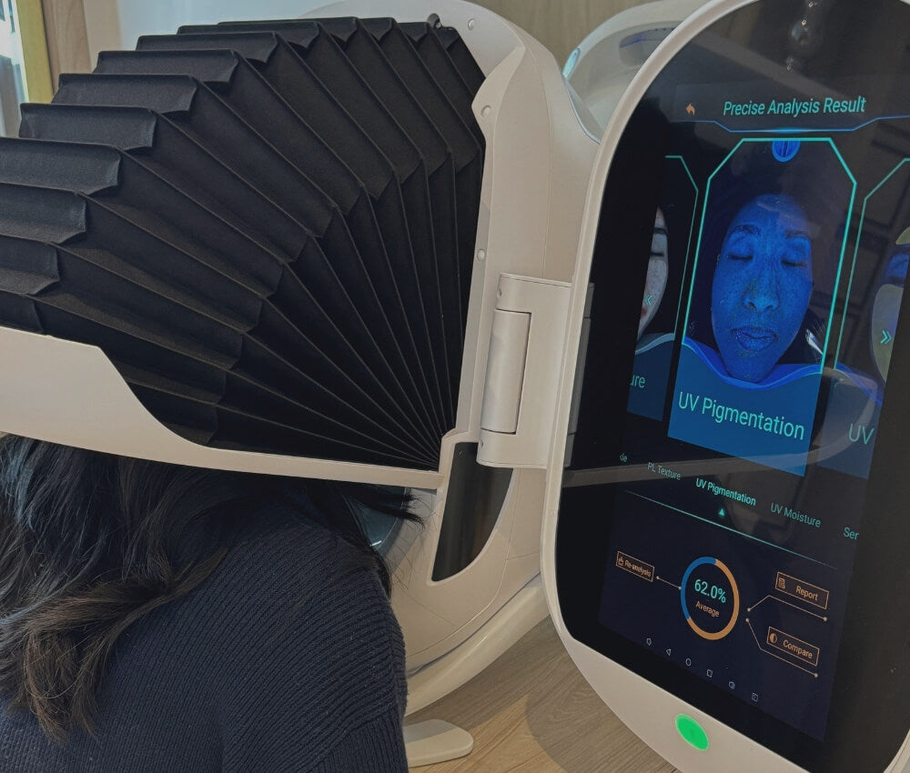 Model undergoing Morpheus8 treatment for facial rejuvenation at Studios Vis a Vis Toronto