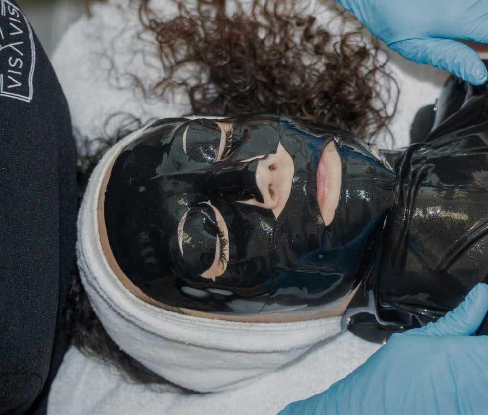 Model undergoing Morpheus8 treatment for facial rejuvenation at Studios Vis a Vis Toronto