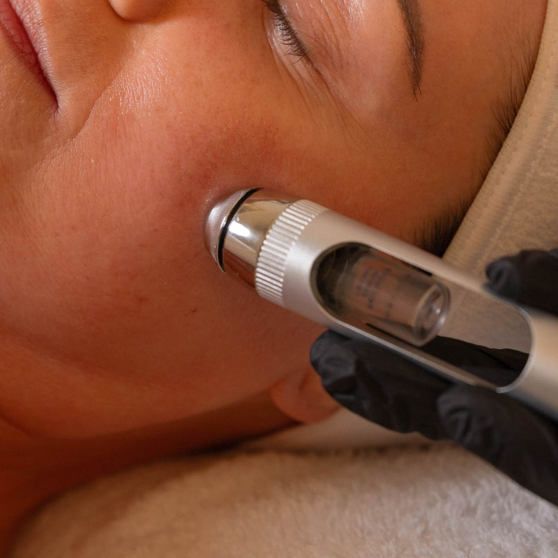 High-performance serum infusion step during the LIFTED facial at Vis A Vis, powered by advanced microcurrent and electroporation.