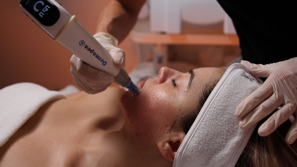 Microneedling