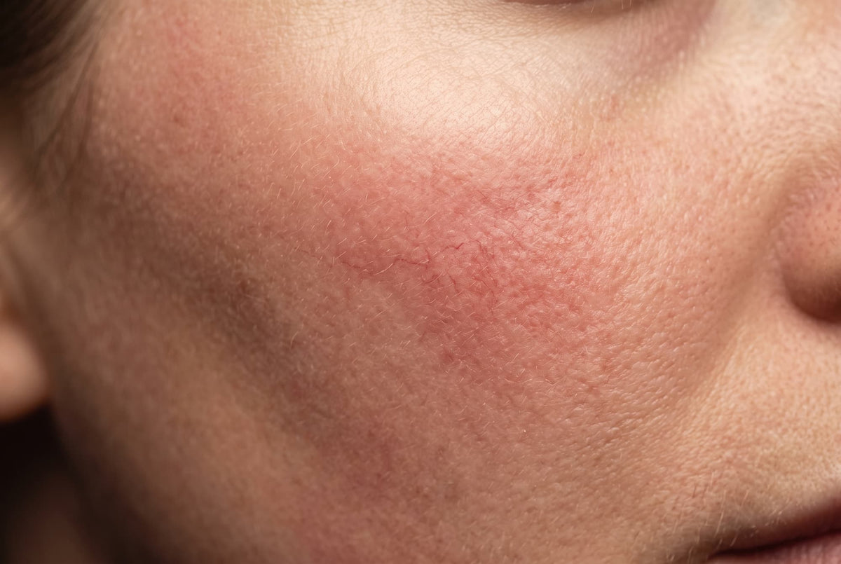 Treatments by skin concern.