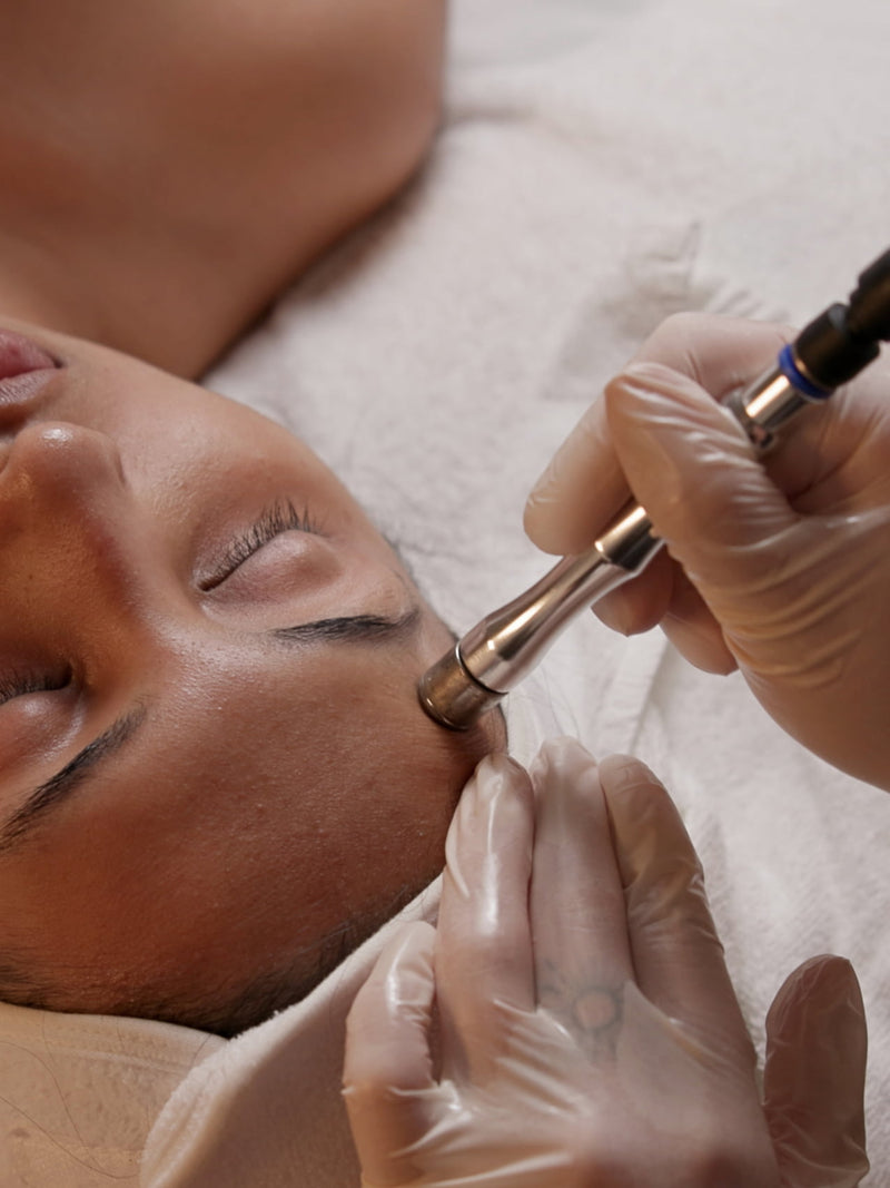 Exfoliation & extractions