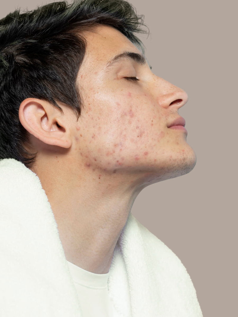 Skin check