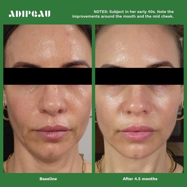 ADIPEAU Volume Cream lifestyle image
