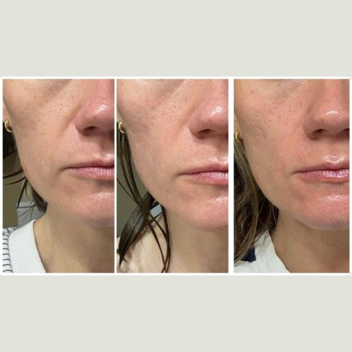 ADIPEAU Volume Cream lifestyle image