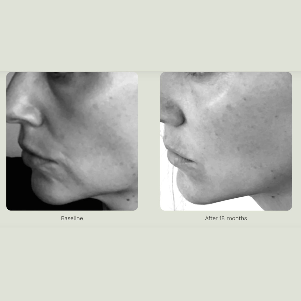 ADIPEAU Volume Cream lifestyle image