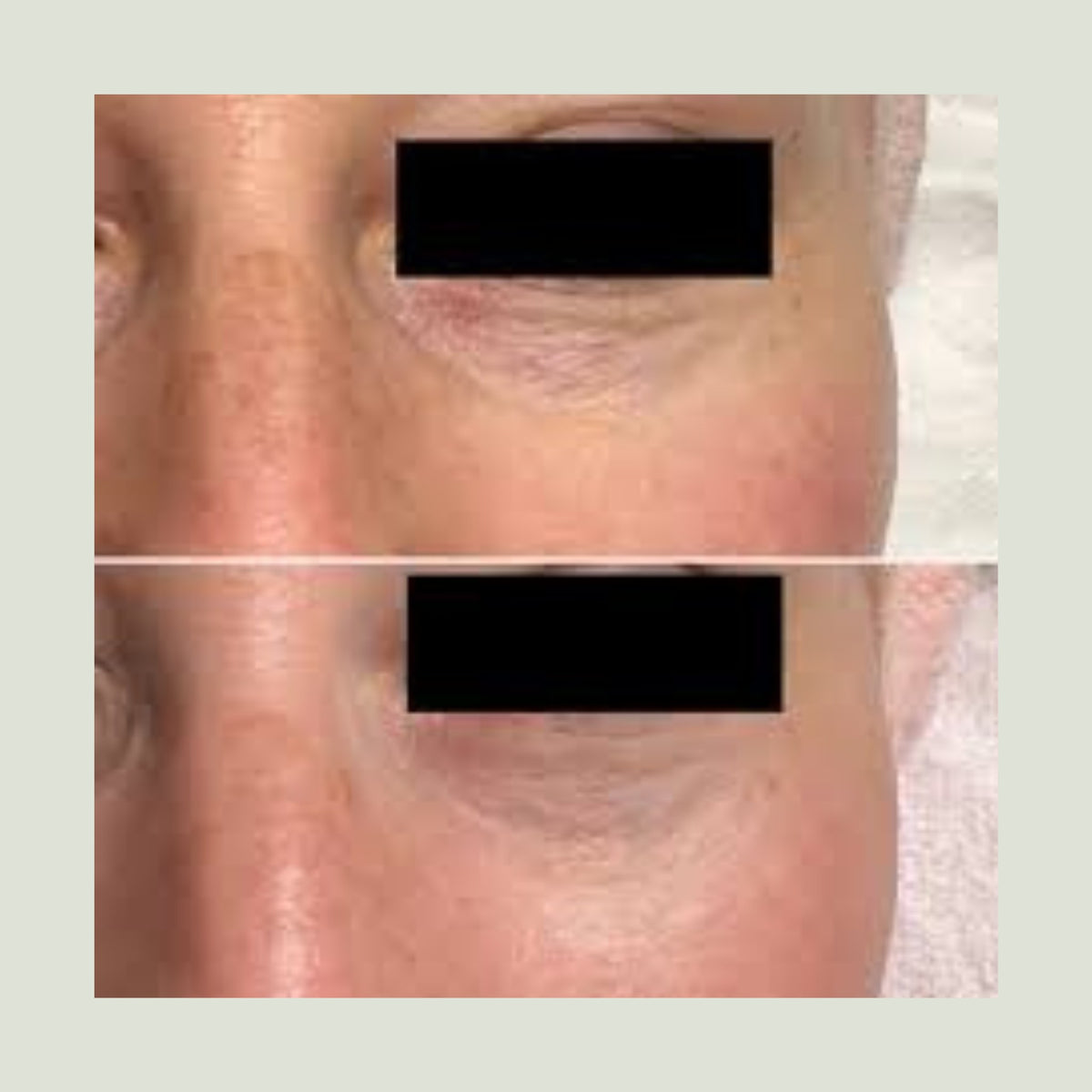 ADIPEAU Volume Cream lifestyle image