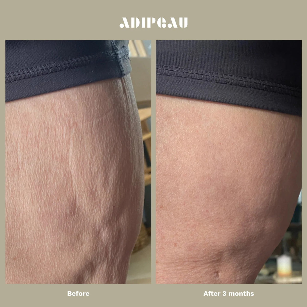ADIPEAU Strength Gel lifestyle image