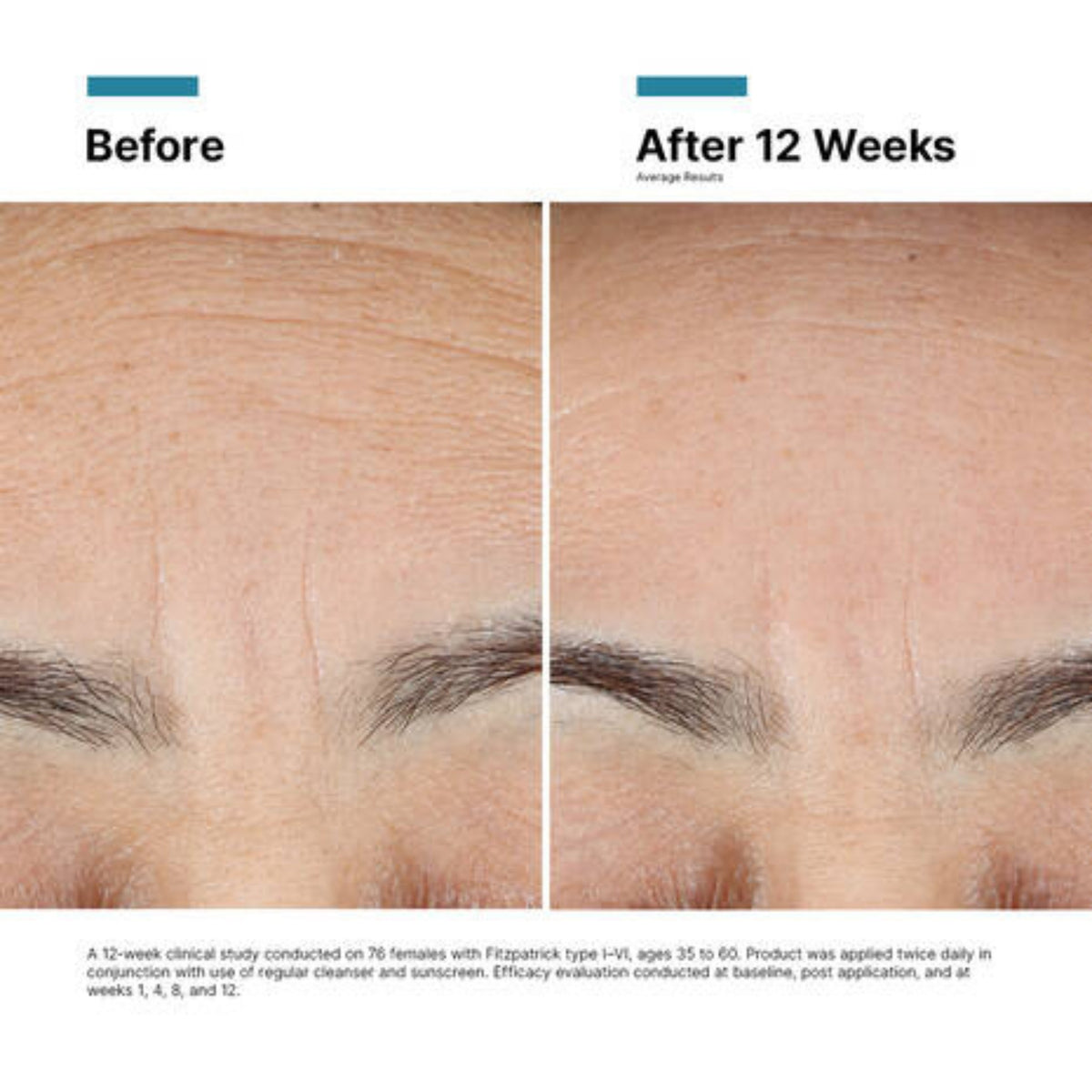 SkinCeuticals Advanced RGN-6 lifestyle image