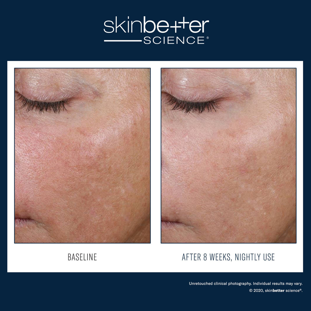 SkinBetter Science AlphaRet Overnight Cream lifestyle image